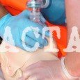 Nonostante tutte le batoste ricevute, ACTA è ancora vivo, seppure in rianimazione. Chi cerca a tutti i costi di tenerlo in vita è la famigerata Commissione Europea, l’organo esecutivo e...
